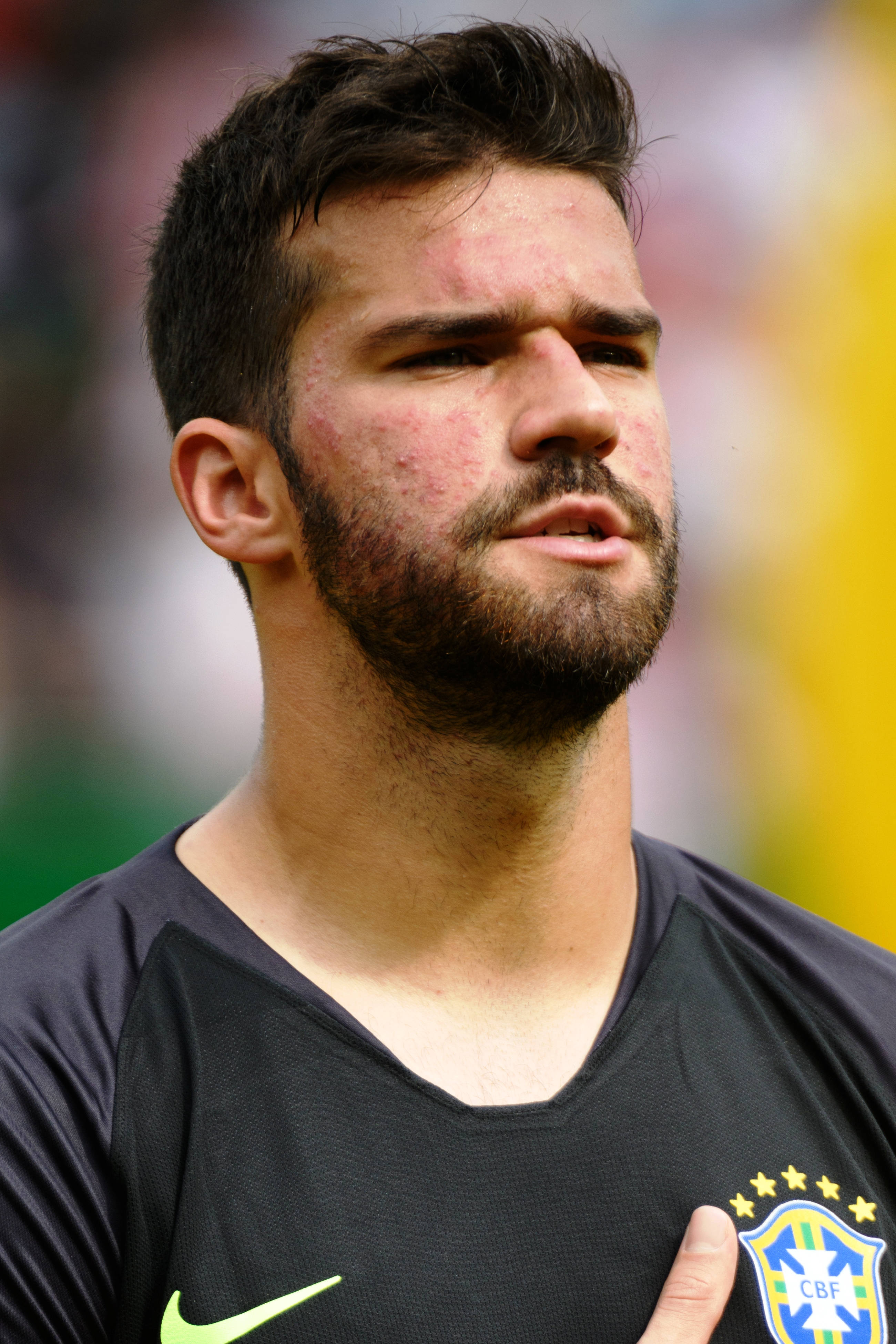 Alisson Becker Cận Cảnh Chân Dung Hình nền